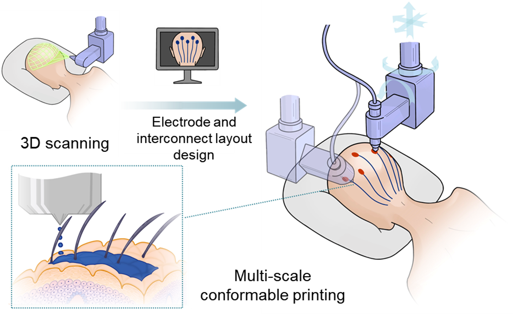 On-scalp printing of personalized electroencephalography e-tattoos